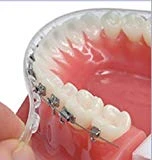 TecnidentUSA Clip-On Comfort Lip Shield/Mouth Protector Guard For Braces - Orthodontic Dental Wax Alternative - 2019 New and Improved